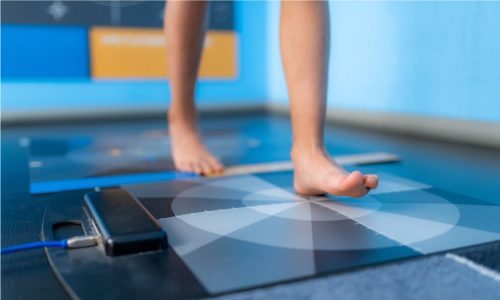 Gait-Analysis