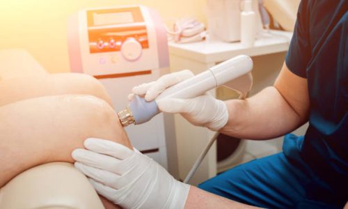 Shock wave therapy. The magnetic field, rehabilitation. Physiotherapist doctor performs surgery on a patient's knee