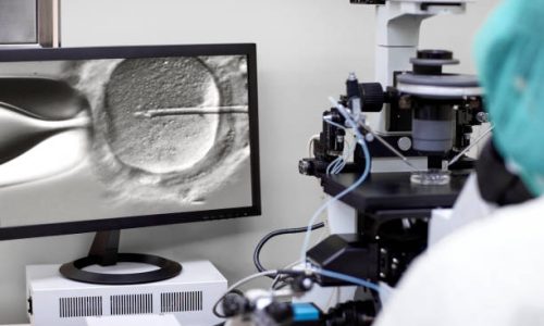 Cropped image of screen showing researcher looking in a microscope fertilising an egg. Intracytoplasmic sperm injection.